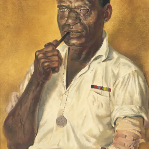 George Aubrey-Crowe, Arm injury – amputation, 1946
